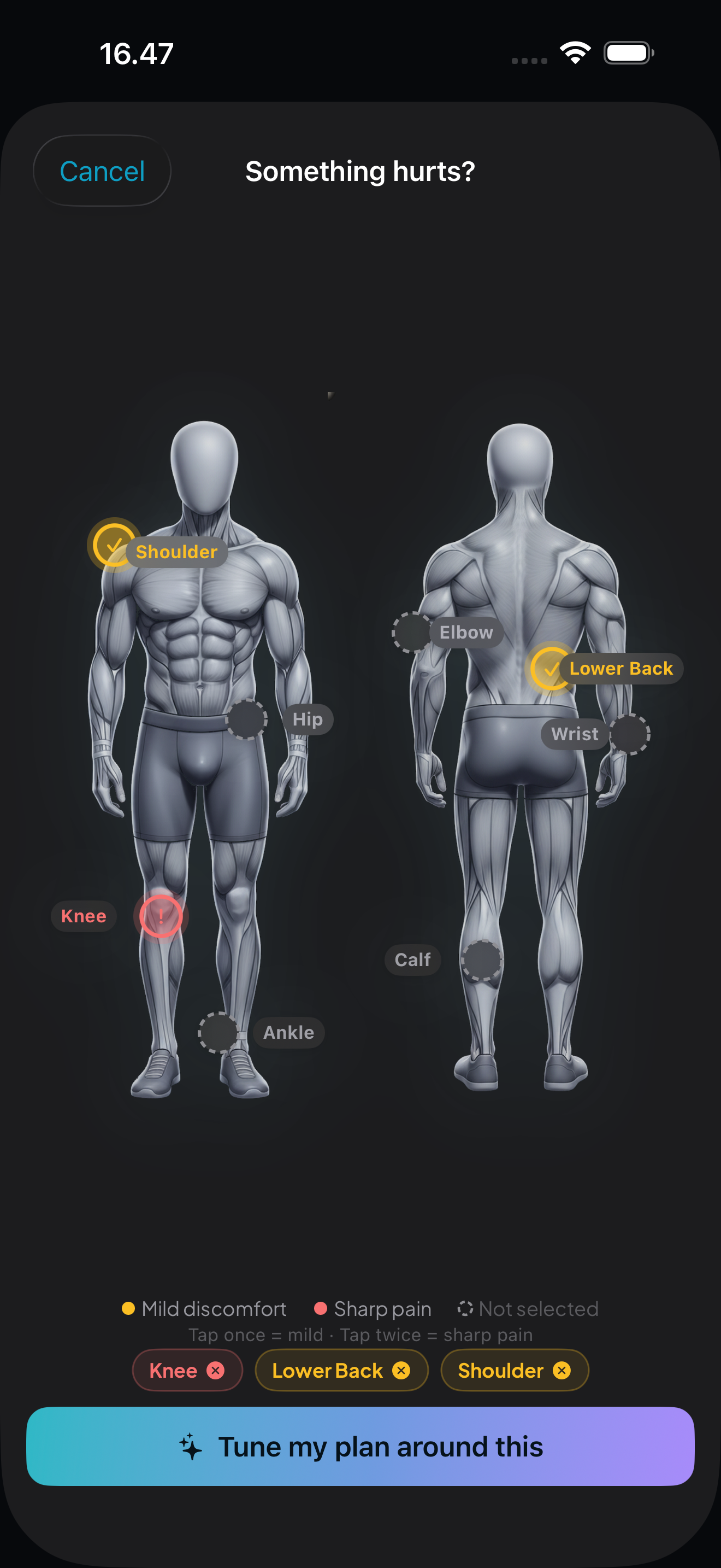 Injury report body map with tappable pain points and severity levels