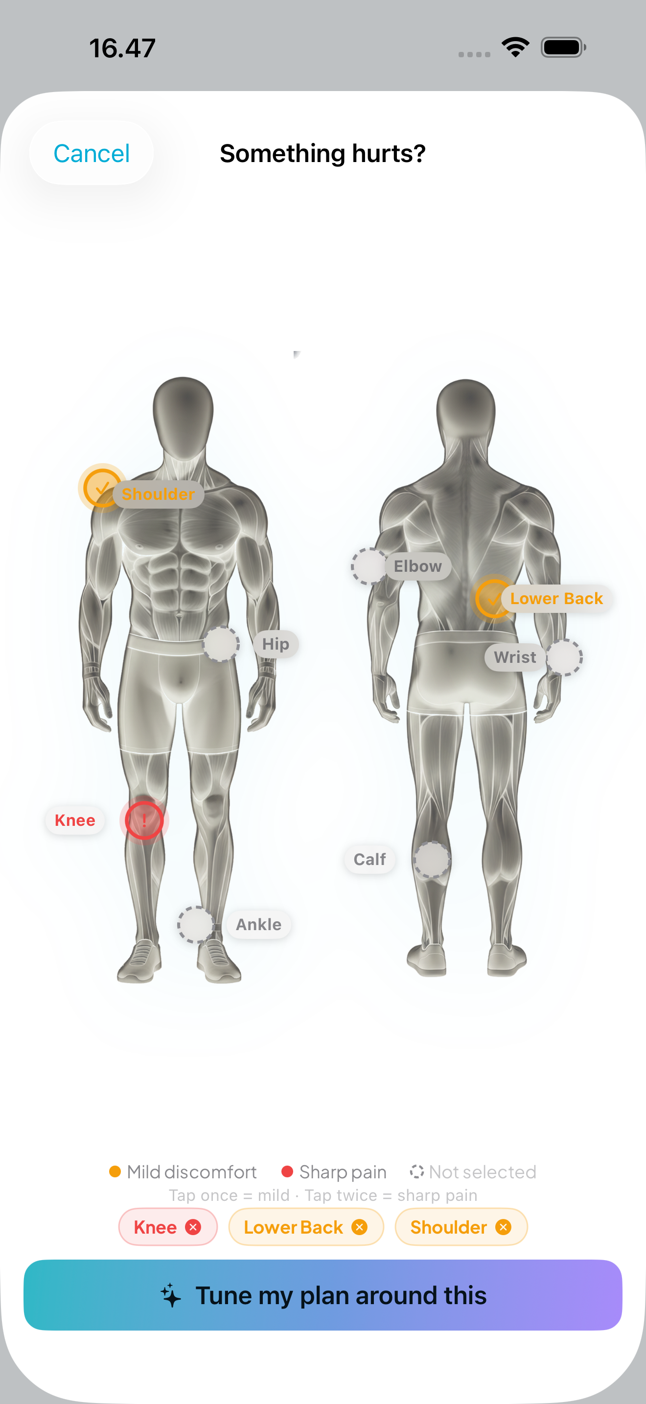 Injury report body map with tappable pain points and severity levels